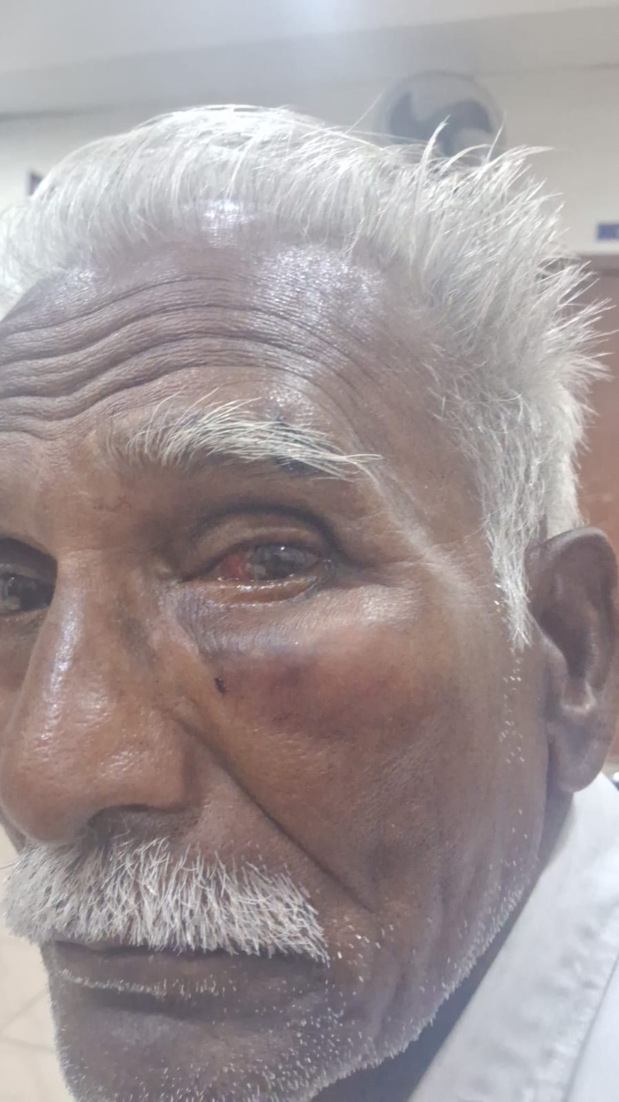 தூத்துக்குடியில் பரபரப்பு: சட்டவிரோத மது விற்பனை குறித்து புகார் அளித்த முதியவர் மீது வீடு புகுந்து தாக்குதல்! காங்கிரஸ் மாநகர் மாவட்டத் தலைவர் தந்தை காயம் – வாலிபரை தேடும் போலீசார்; கட்சியினர் கண்டனம்!!